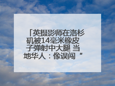 英摄影师在洛杉矶被14毫米橡皮子弹射中大腿 当地华人：像误闯“末日生存”游戏